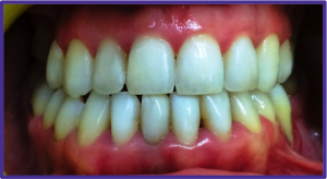 orthodontic Tucker