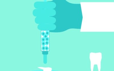 Stem Cell Therapy in Dentistry: Regenerative Healing Without Root Canals