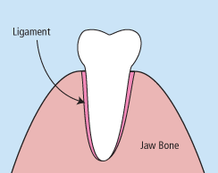 dental extractions near atlanta