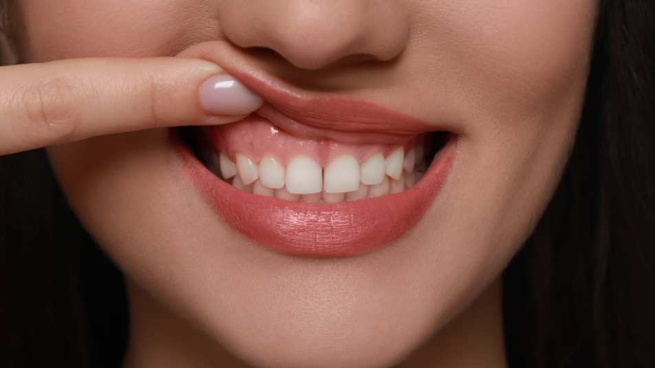gum disease treatment near atlanta ga