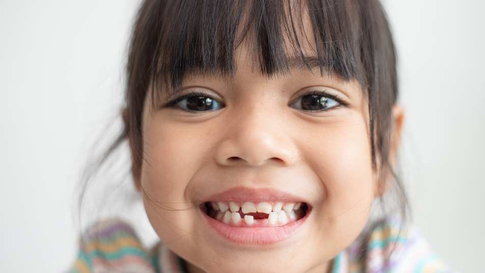 pediatric dentist in tucker, ga