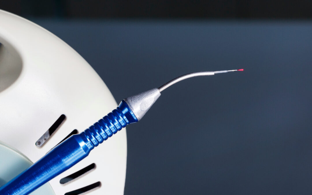 Laser Dentistry: Can You Get Pain-Free Fillings Without Anesthesia?