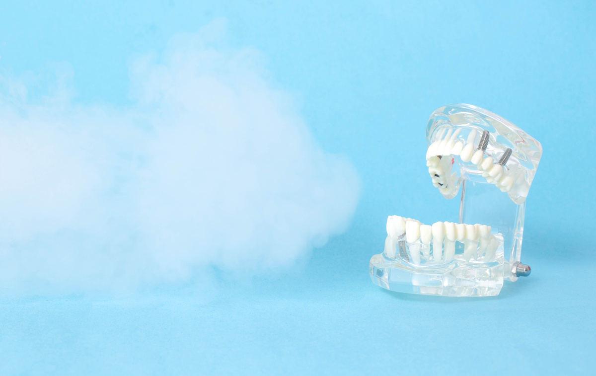 Dental jaw model on a blue background with ozone. The concept of dental treatment with ozone therapy in dentistry. Copy space for text