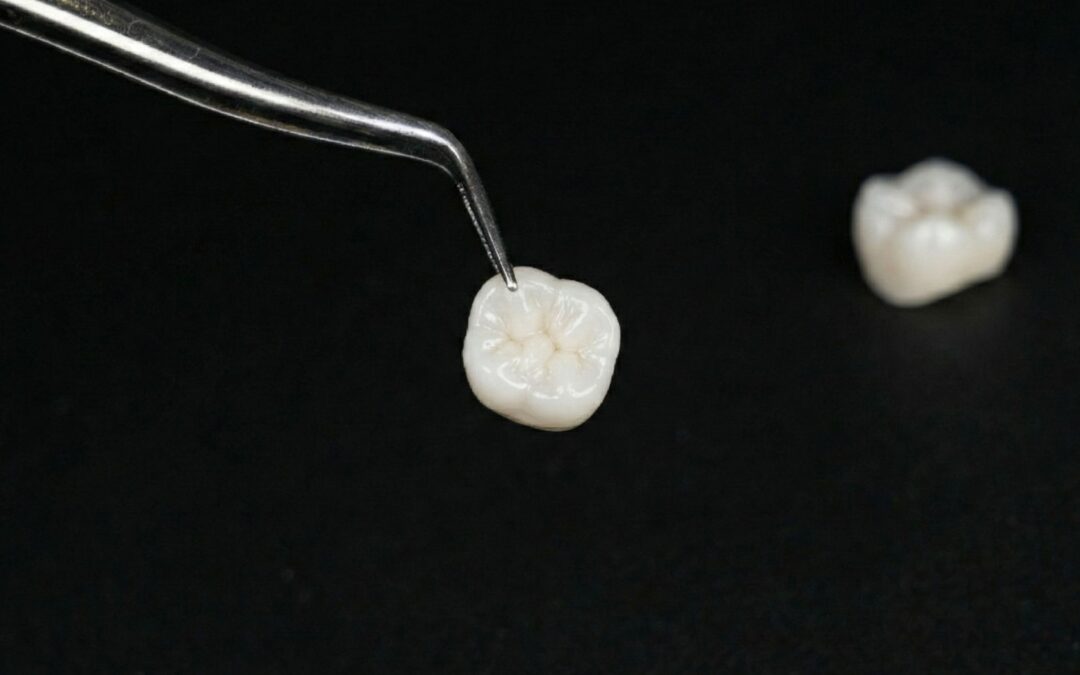 What Is Biomimetic Dentistry? A Natural Approach to Tooth Restoration