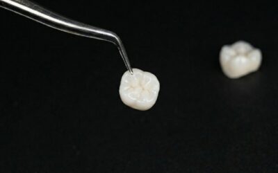 What Is Biomimetic Dentistry? A Natural Approach to Tooth Restoration