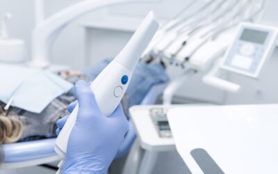 Digital Impressions vs. Traditional Molds: Comfort Meets Precision