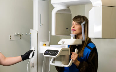 What Is a Cone Beam CT Scan and Why Do Holistic Dentists Use It?