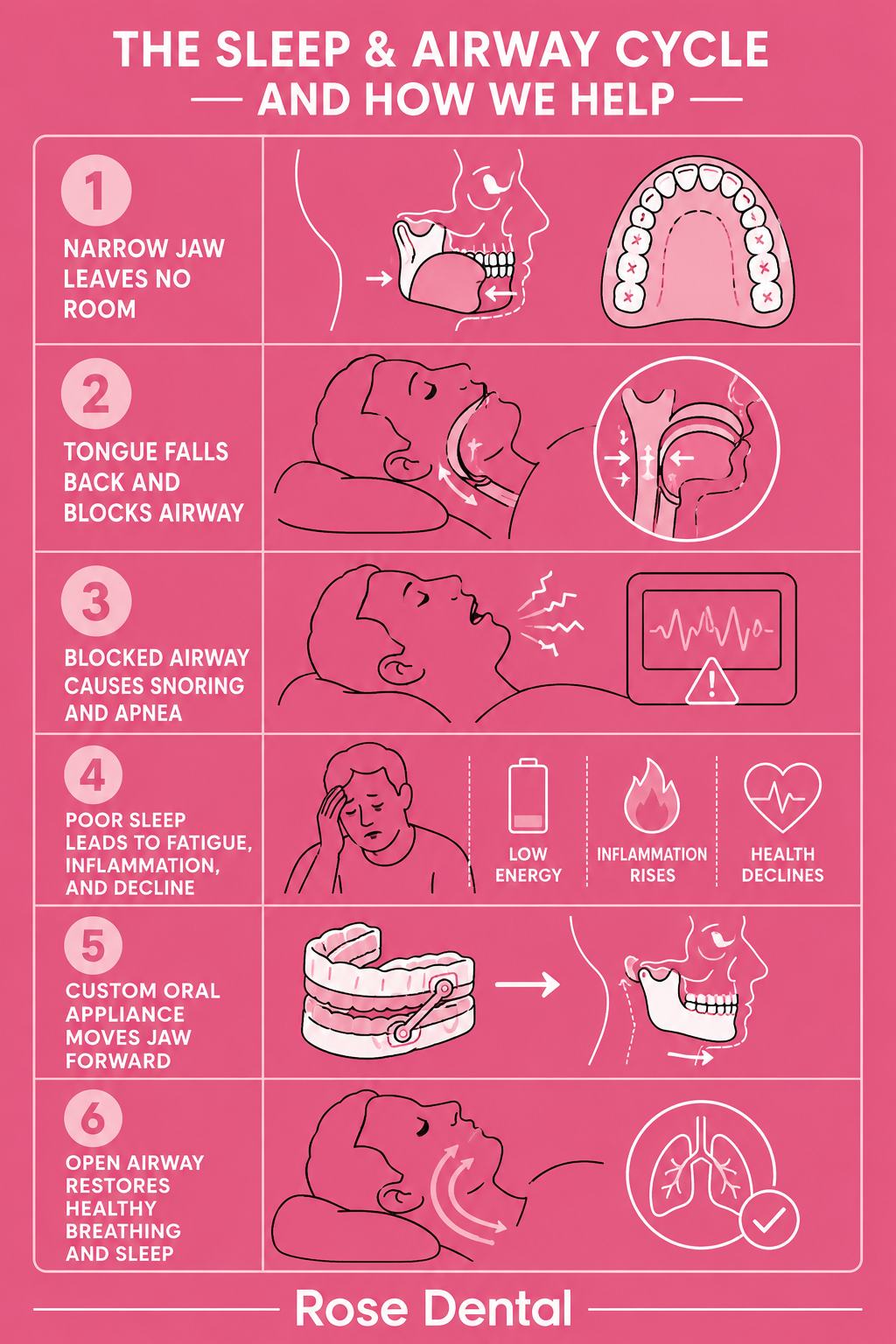 Infographic explaining what airway appliances are and how they improve sleep and health – Rose Dental
