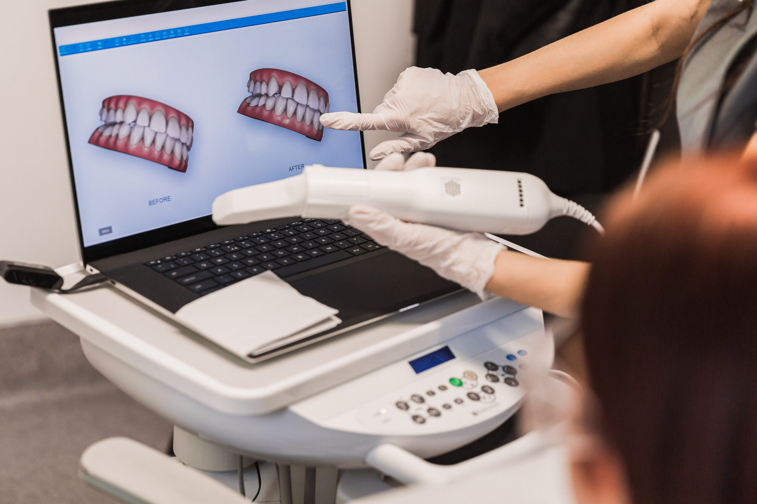 Dentist Using 3D Imaging – Cone Beam CT – Rose Dental Dentist using innovative 3D imaging technology for a dental check at Rose Dental in Tucker, GA