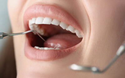 What Is Biomimetic Dentistry and How Does It Protect Your Natural Teeth?