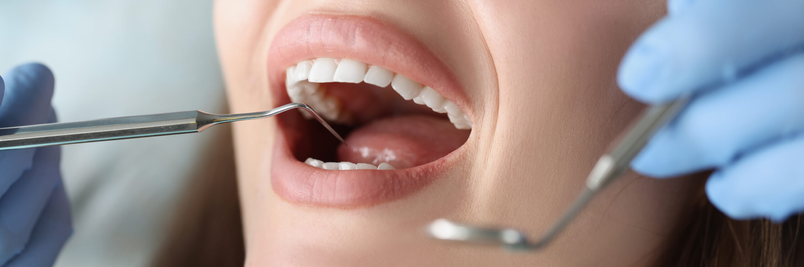 Dentist Examining Patient – Biomimetic Dentistry Rose Dental Dentist examining the oral cavity of a woman patient at Rose Dental in Tucker, GA