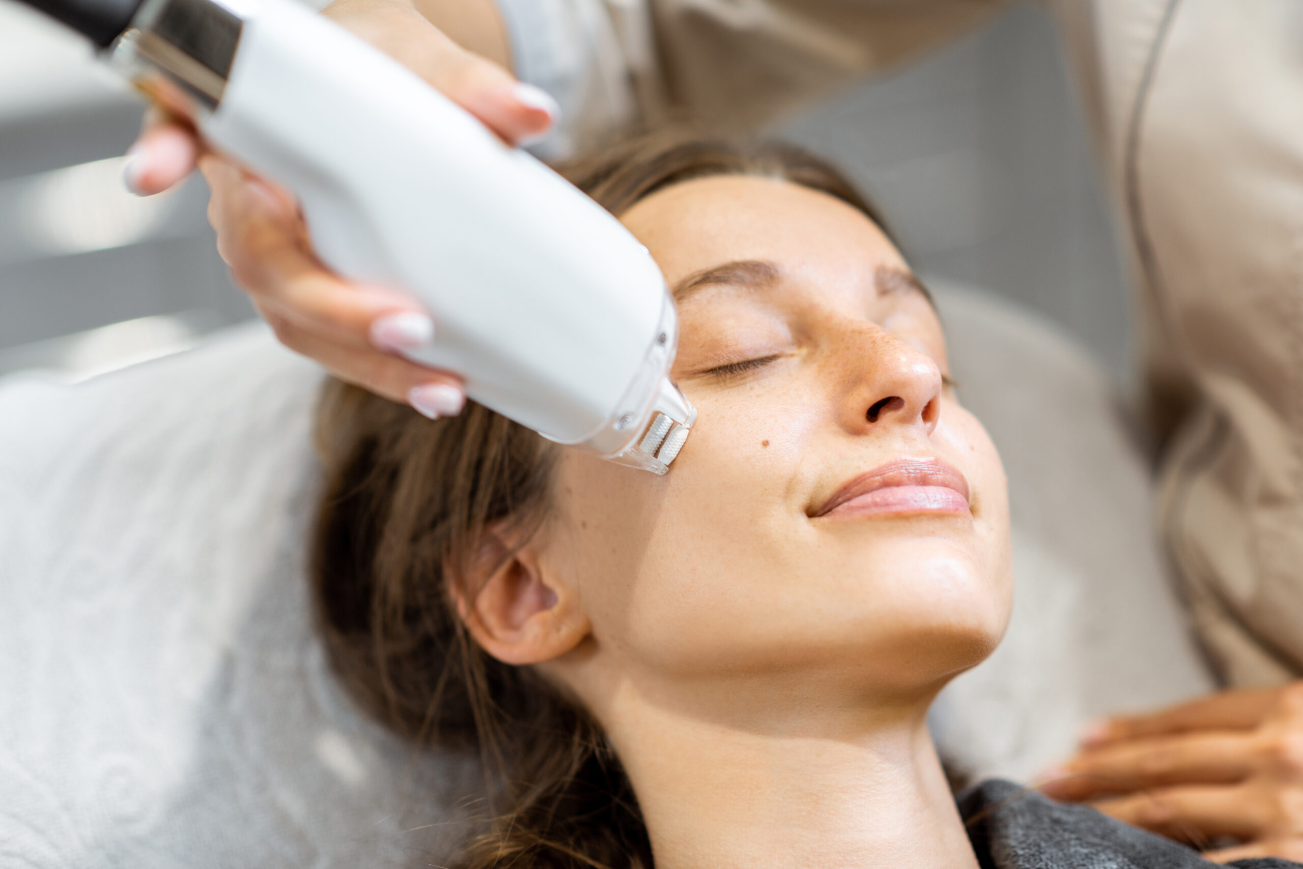PRF facial rejuvenation treatment PRF microneedling facial treatment at Rose Dental