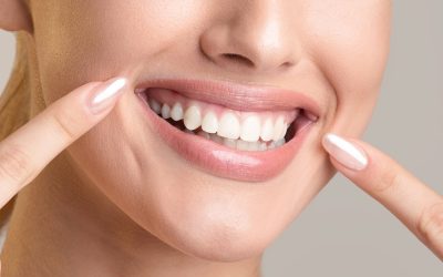The Role of Teeth Whitening in a Holistic Smile Makeover